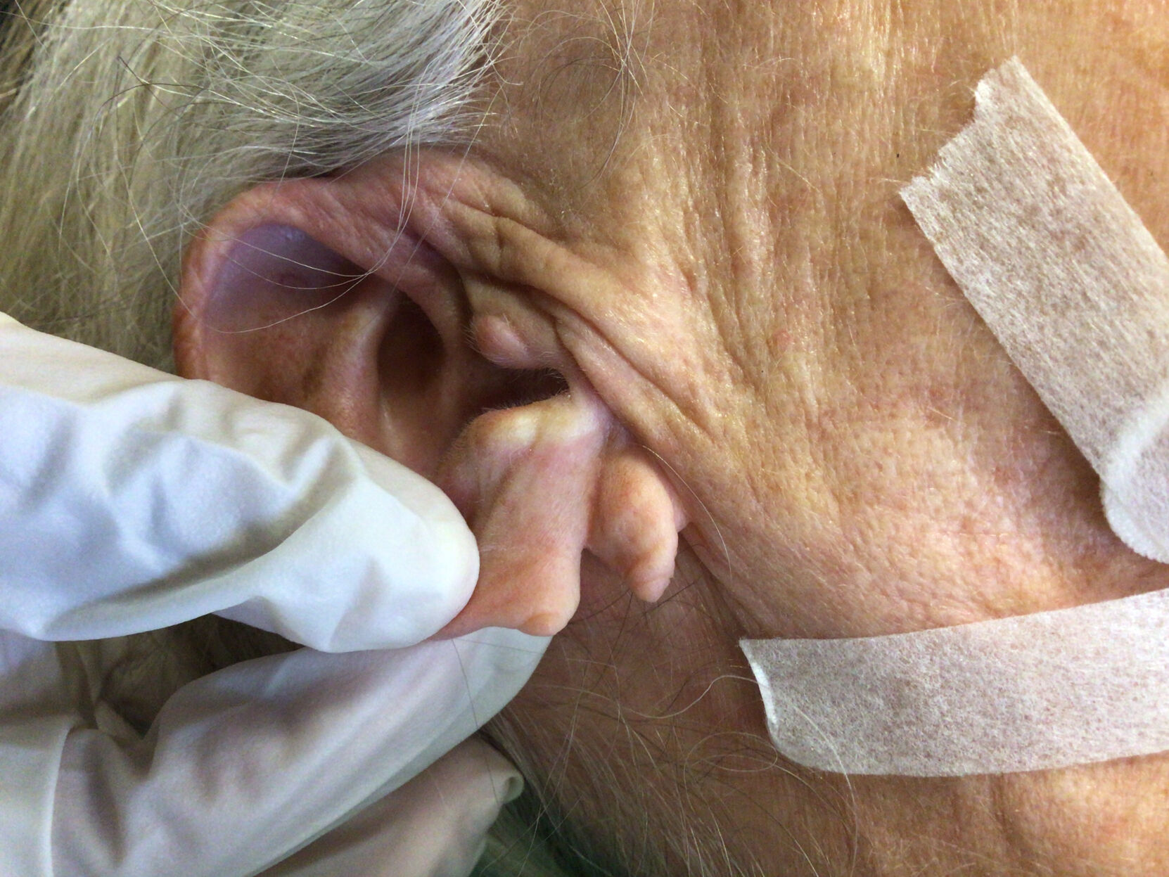 ear 2